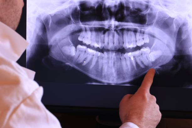 Best Emergency Dentist for Lost Fillings or Crowns in North New Hyde Park, NY